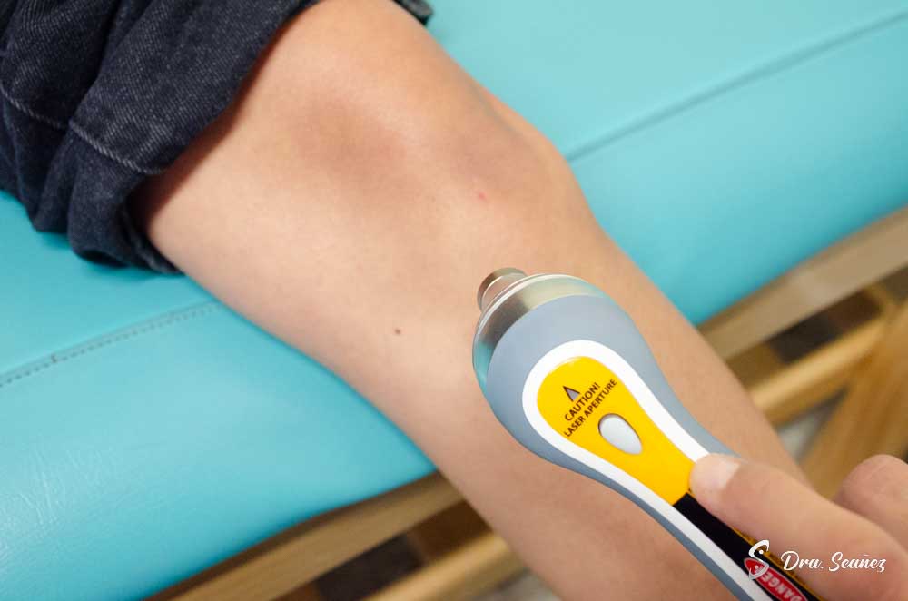 La laser terapia es una técnica innovadora que utiliza luz láser para estimular la curación y aliviar el dolor. En FisioDoctors, aplicamos esta terapia para tratar una variedad de condiciones, mejorando la recuperación y reduciendo la inflamación.